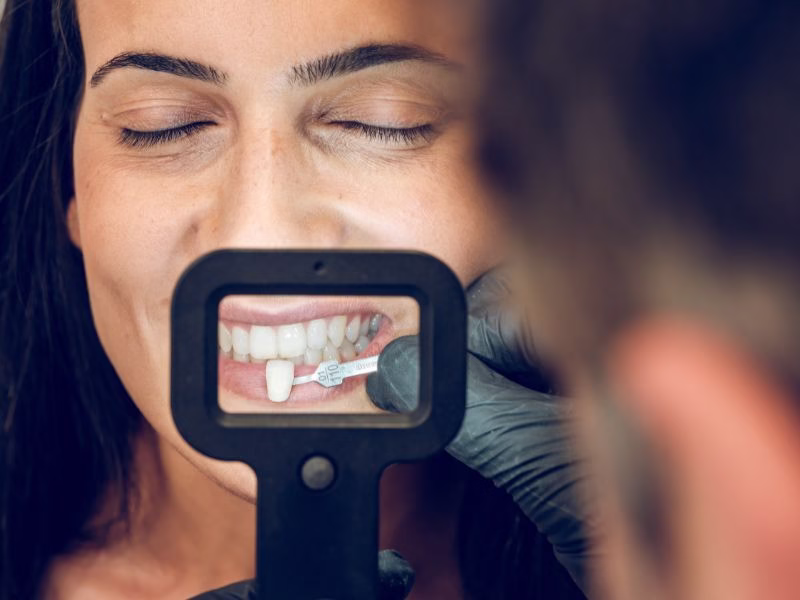 Rehabilitación oral