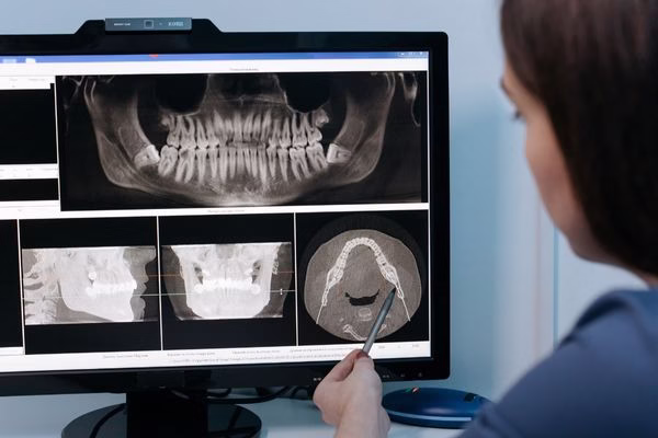 Cirugía guiada de implantes 